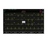 Cardiomate 3 Spengler ECG