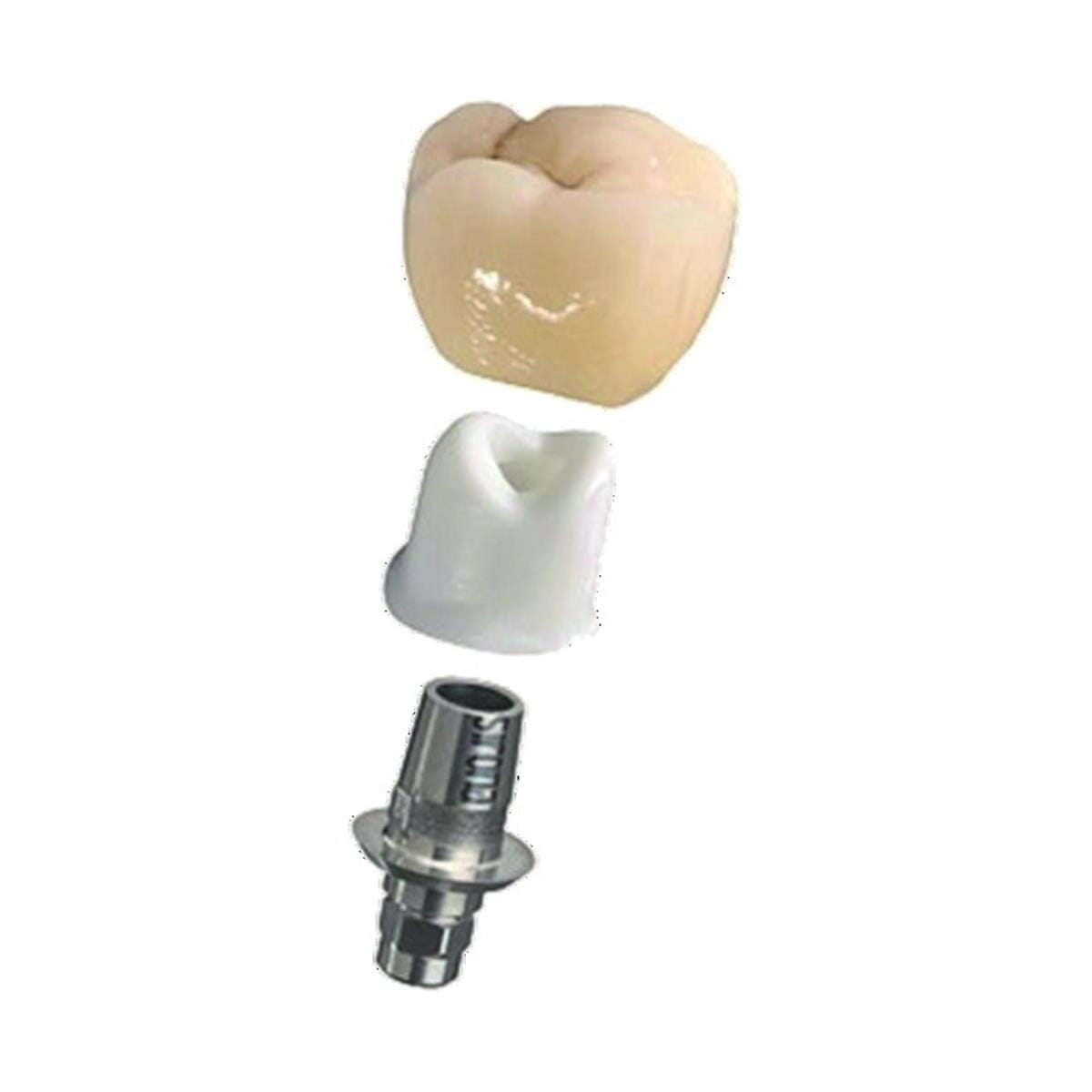 TiBase Set NBB – Base titane pour implant (Dentsply Sirona)